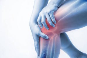 ARTHRITIS contraindications In beauty therapy