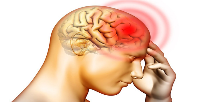 BRAIN HAEMORRHAGE contraindications In beauty therapy